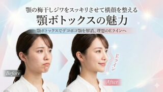 顎ボトックス治療による梅干しジワの改善と横顔のEラインが整った女性のビフォーアフター比較